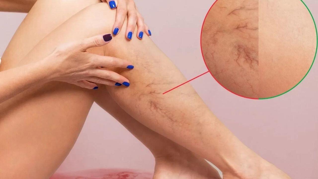 जान लें Vitamin D की कमी के 5 हिडन लक्षण, जो धीरे-धीरे आपकी लाइफ बर्बाद कर रहे