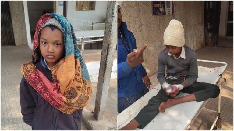 रीवा में मोबाइल की पुरानी बैटरी ब्लास्ट: पढ़ाई कर रहे दो भाई घायल, बड़े बेटे की उंगलियां उड़ीं
