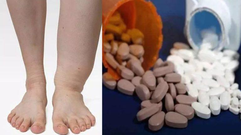 छत्तीसगढ़ में फाइलेरिया उन्मूलन के लिए 10 फरवरी 2026 से बड़ा अभियान, 18 जिलों में 1.58 करोड़ लोगों को मुफ्त दवा खिलाने का लक्ष्य