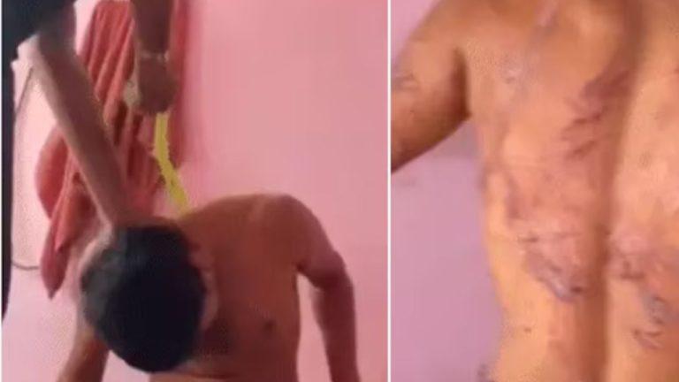 इलाज के नाम पर अत्याचार! रायपुर के नशामुक्ति केंद्र में युवक को बेरहमी से पीटा