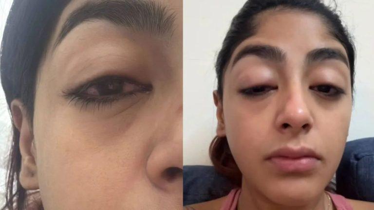 Splitsvilla X6 फेम प्रीत सिंह पर मुंबई क्लब में हमला: टूटे दांत, सूजा चेहरा, रोते हुए बताई आपबीती!