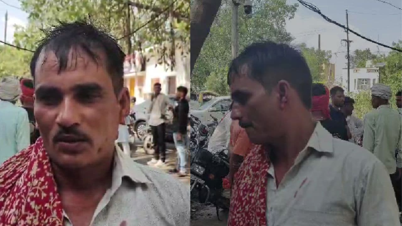 5 रुपये के लिए ऐसा झगड़ा कि उड़ गए होश! भिंड में ग्राहक का कान दांत से काटा