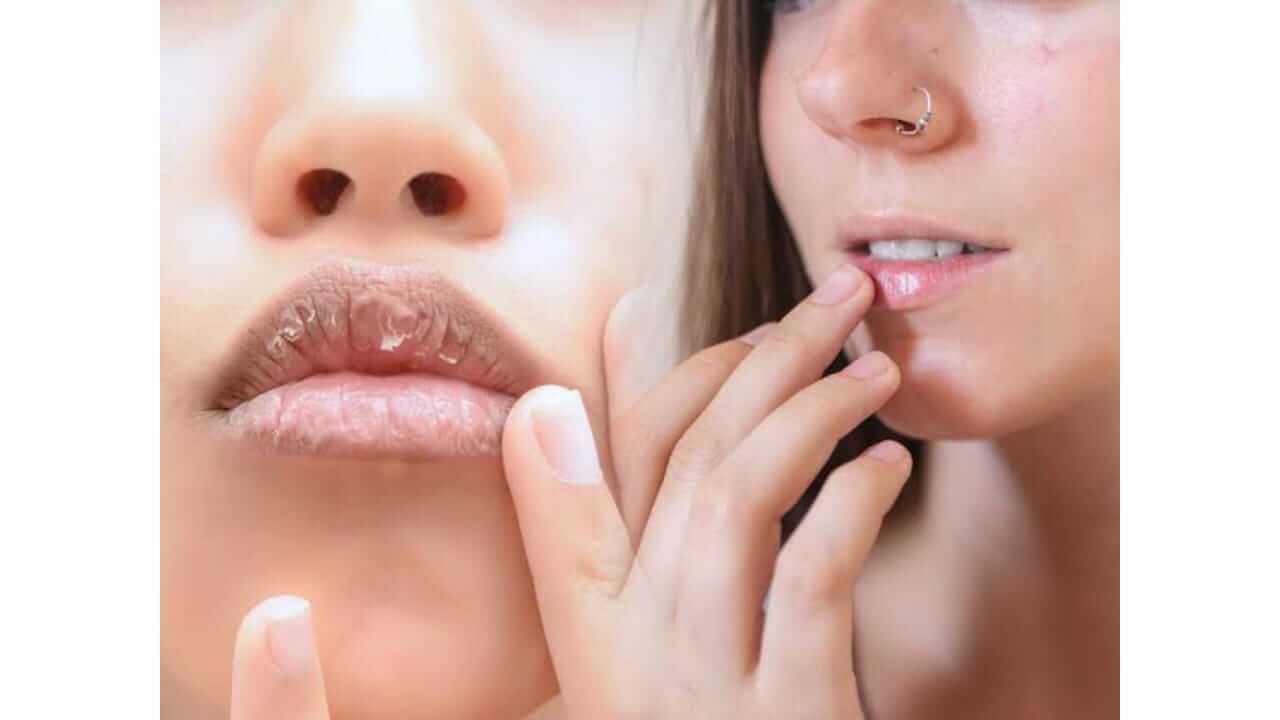 पावसाळ्यात तुमचे ओठ कोरडे पडत आहेत का? ‘या’ सोप्या टिप्स फॉलो करा