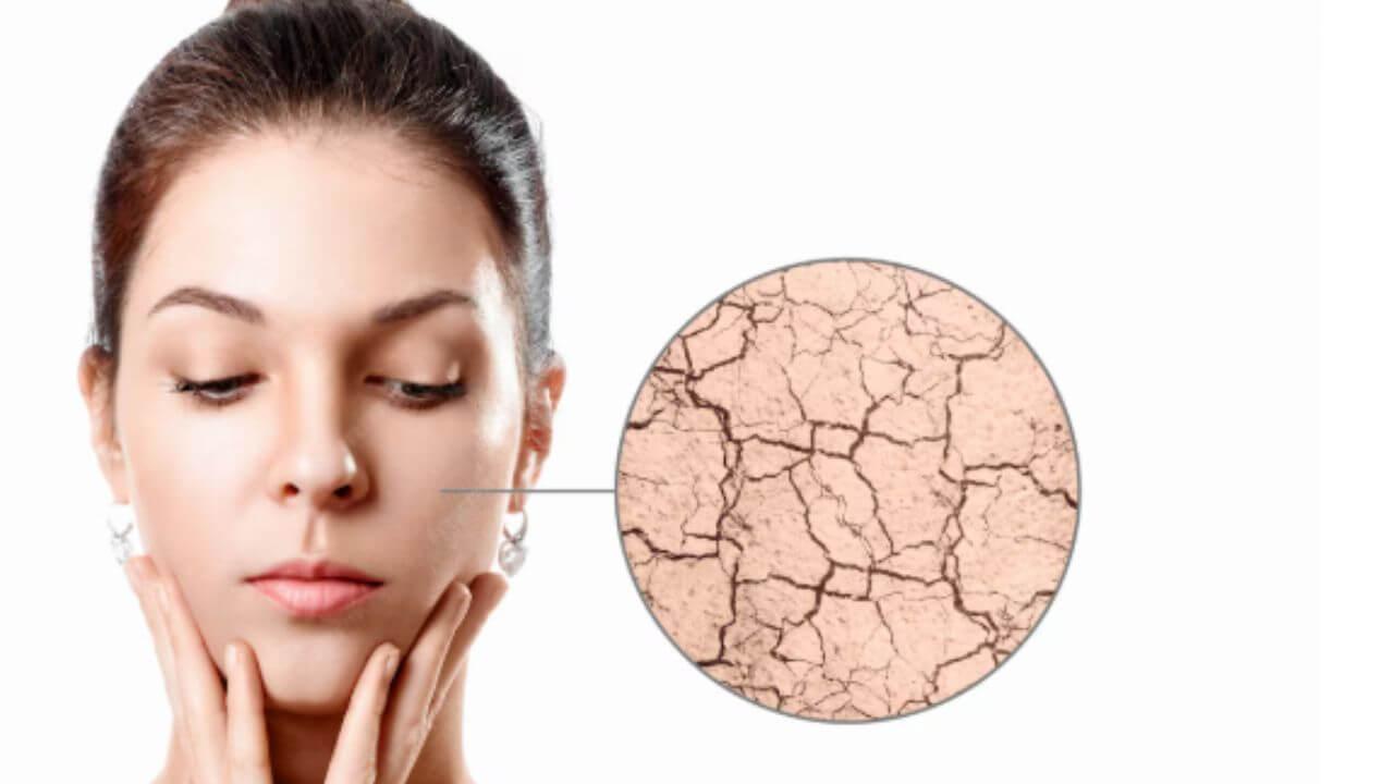 थंडीमुळे चेहऱ्याची त्वचा कोरडी होऊन खडबडीत झालीय? मग करा ‘हे’ घरगुती उपाय