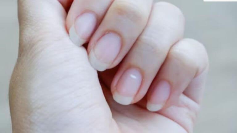 White Spots on Nails : नखांवरील पांढरे डाग देतात नशिबाचे संकेत वाचा काय सांगत शास्त्र…