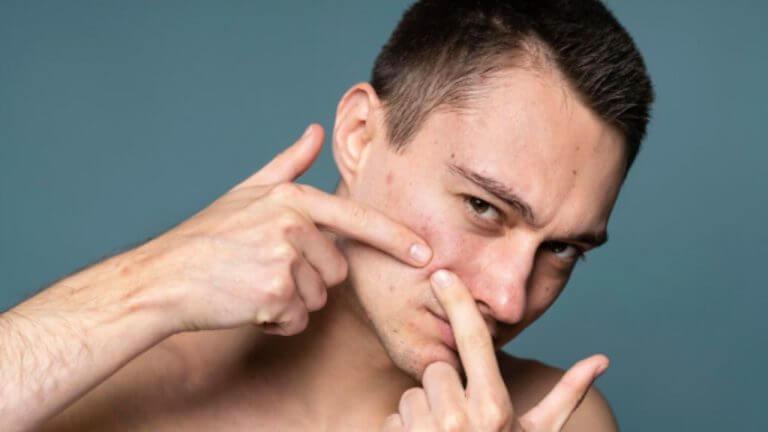 पिंपल्स येऊन खाज सुटतेय? ‘हे’ घरगुती उपाय दूर करतील समस्या