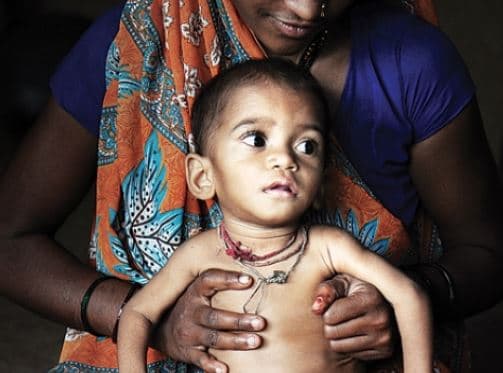 स्वास्थ्य व पोषण के क्षेत्र में आकांक्षी जिलों में प्रथम स्थान पर रहा खण्डवा जिला