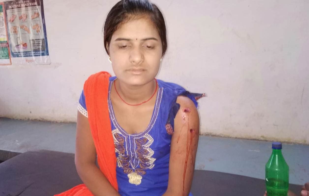 जंगली जानवर के हमले से 18 वर्षीय युवती घायल
