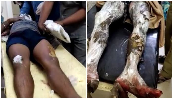 नगर परिषद अध्यक्ष के घर में विस्फोट, चार लोग गंभीर घायल