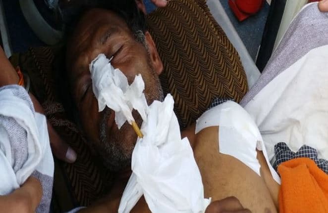 आपसी रंजिश में अधिकारी ने पिता-पुत्र को गोली मारी, बेटे की मौत