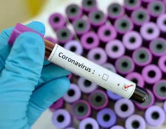Corona update: प्रदेश की हालत गंभीर, 741 संक्रमित सहित 53 ने गवाई जान, स्वास्थ्यकर्मी भी चपेट में