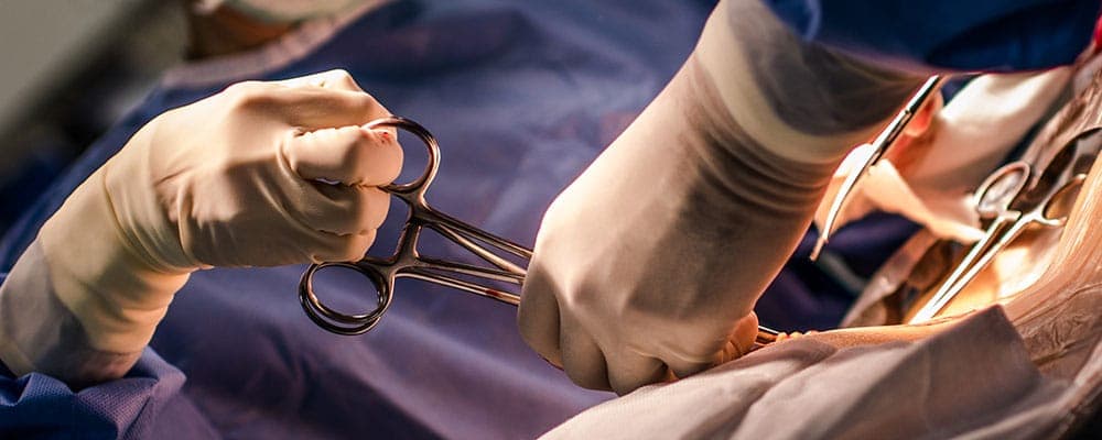 उज्जैन : डॉक्टर की लापरवाही, महिला की सिजेरियन डिलीवरी के दौरान छोड़ा 40 सेमी लंबा कपड़ा