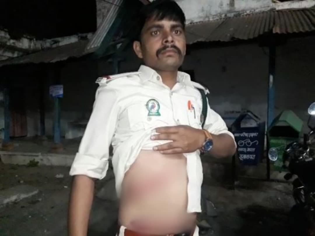 जंगल में जाने से रोका तो आरोपी ने वनरक्षक पर डंडे से कर दिया हमला, मामला दर्ज, जांच शुरु