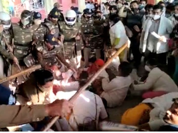 Gwalior News : स्वास्थ्यकर्मियों पर लाठीचार्ज का मुद्दा गर्माया, AIDYO का प्रदेशभर में प्रदर्शन