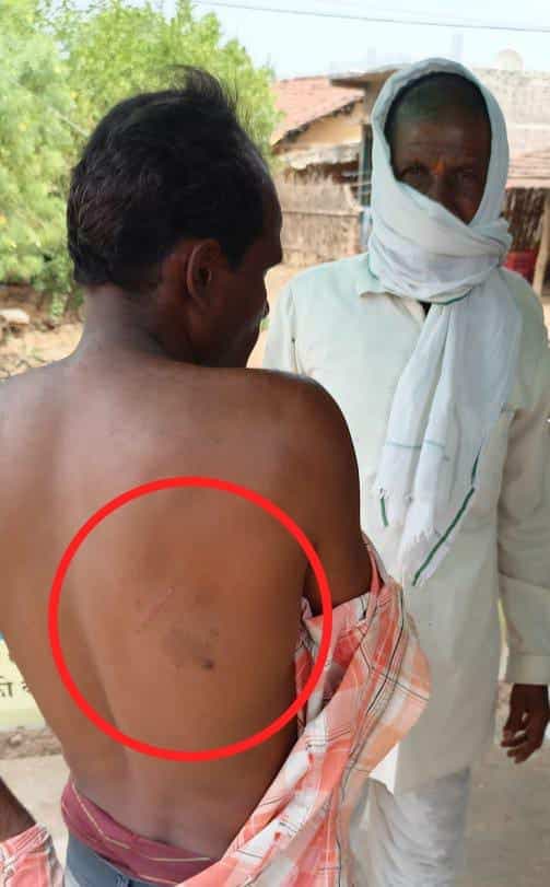 देवास: तेंदू पत्ता तोड़ने गए युवक पर तेंदुए ने किया हमला, बमुश्किल बचाई जान