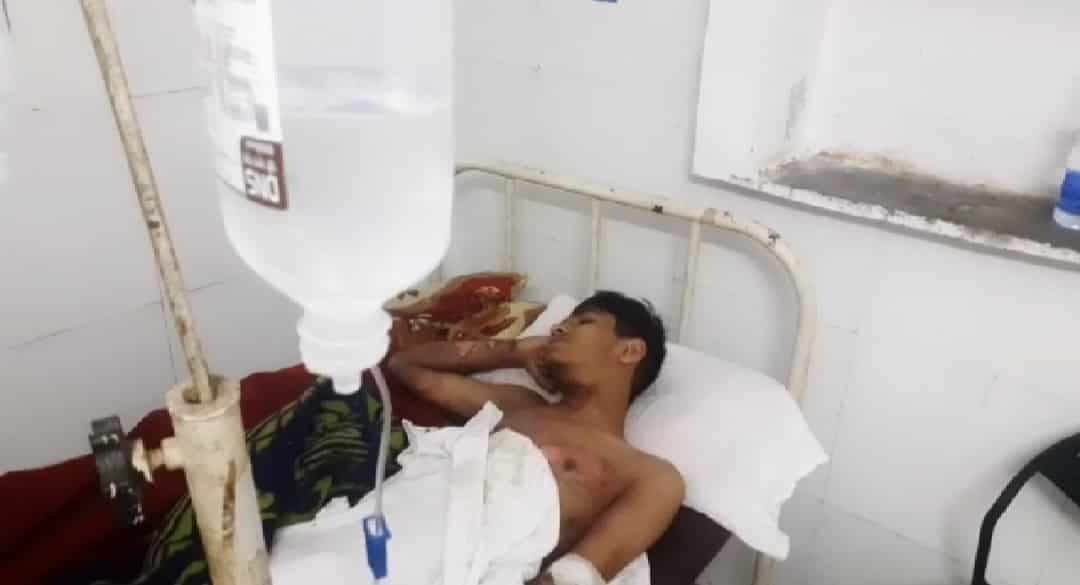 Ratlam: सेल्फी के चक्कर में हाई टेंशन तार से चिपका नाबालिग, बुरी तरह से झुलसा