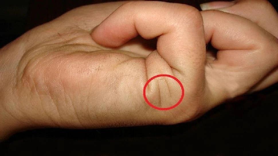 Vivah Rekha : क्या आपके हाथ में भी है ऐसी विवाह रेखा? अमीर जीवनसाथी के साथ मिलेगा ये सब