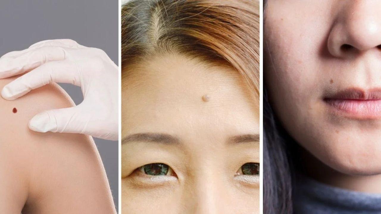 Lucky Moles: महिलाओं के चेहरे और गर्दन पर तिल का होता है ये मतलब, जानें यहां