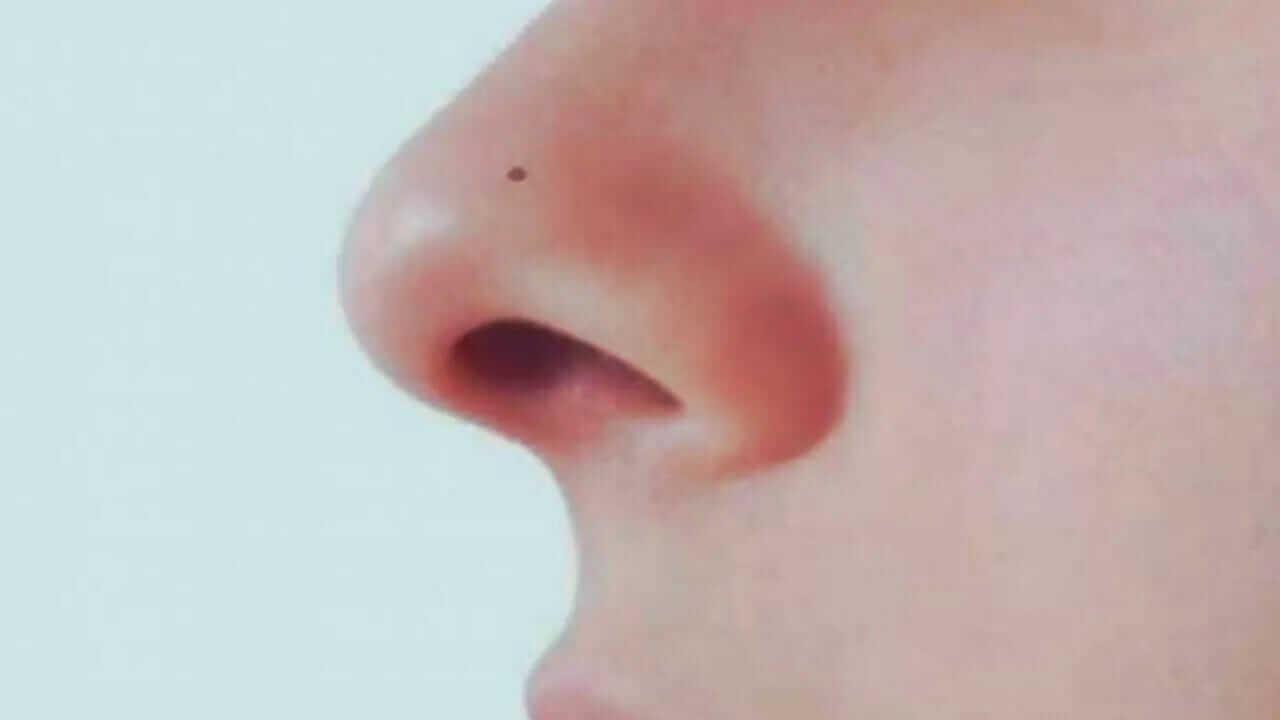 Personality Test: नाक पर मौजूद तिल खोलेगा व्यक्तित्व के राज, उजागर होंगे छुपे हुए गुण