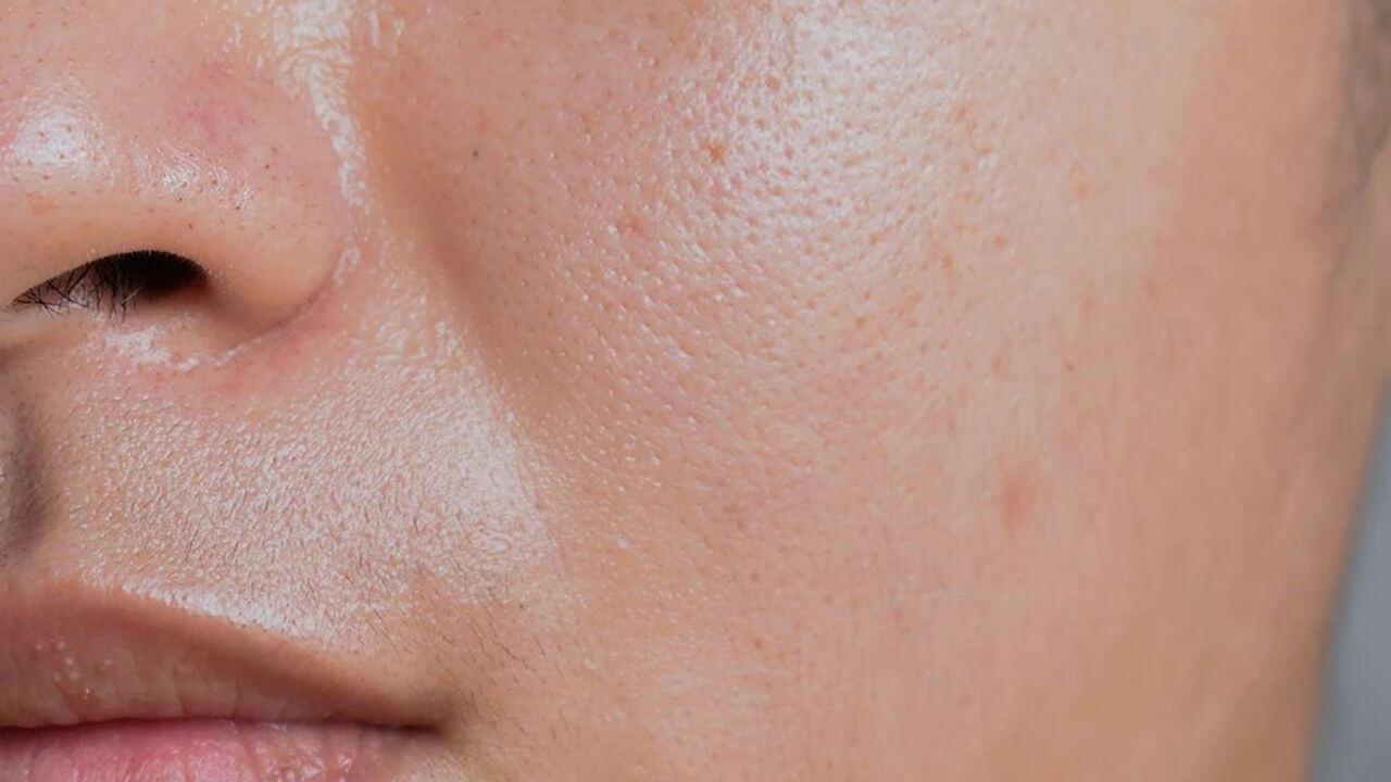 चेहरे का हाल बुरा कर सकती हैं ये 2 चीजें, Oily Skin वालों के लिए बड़ा खतरा
