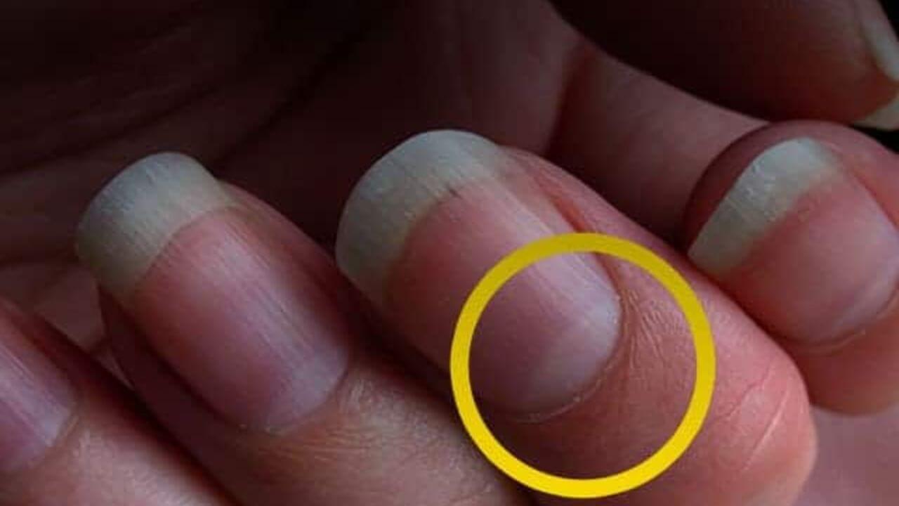 नाखूनों पर आधे चांद का निशान क्या बताता है? जानिए इसके पीछे छिपे संकेत