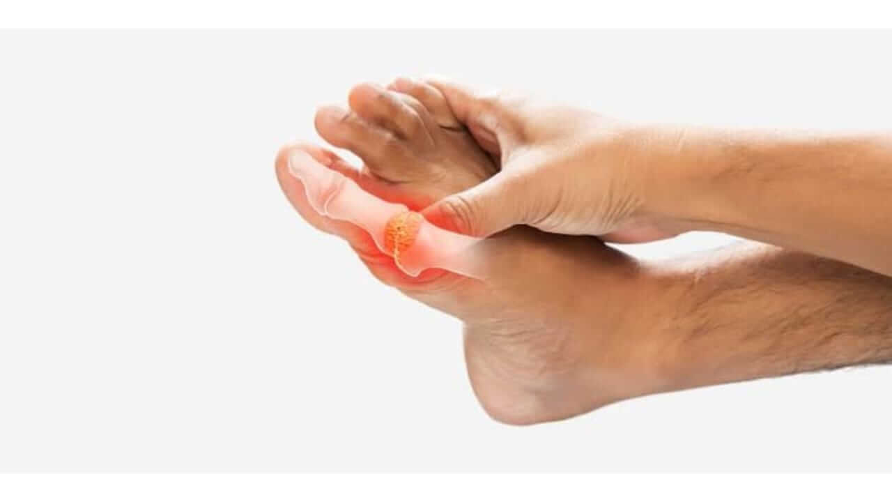 घरी बसून तुम्ही युरिक अ‍ॅसिडची पातळी कमी करू शकता, या उपायांचे करा पालन