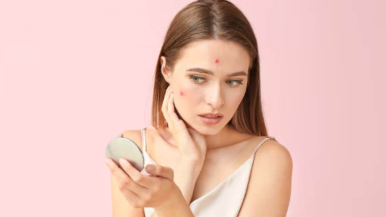 तेलकट त्वचेवर सतत पिंपल्स का येतात? ‘हे’ फेस पॅक देतील नितळ त्वचा