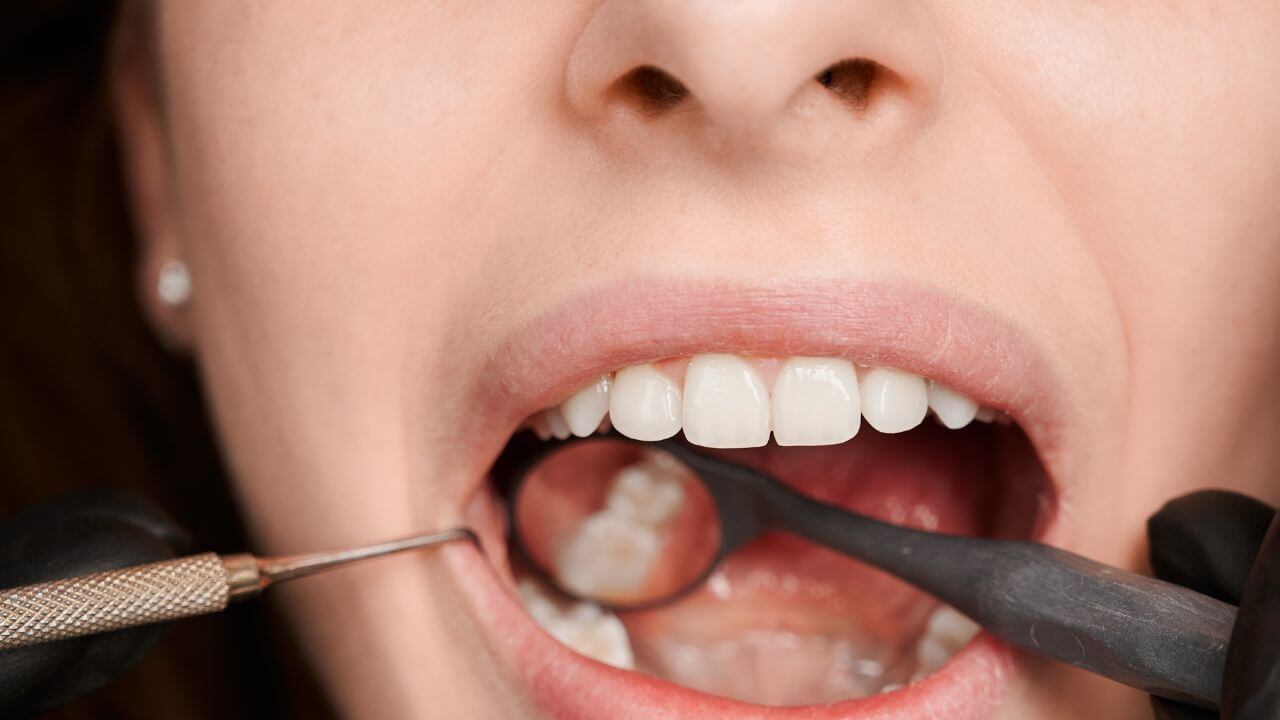 दात किडण्याची समस्या वाढलीय? मजबूत आणि निरोगी बनवण्यासाठी करा ‘हे’ सोपे उपाय