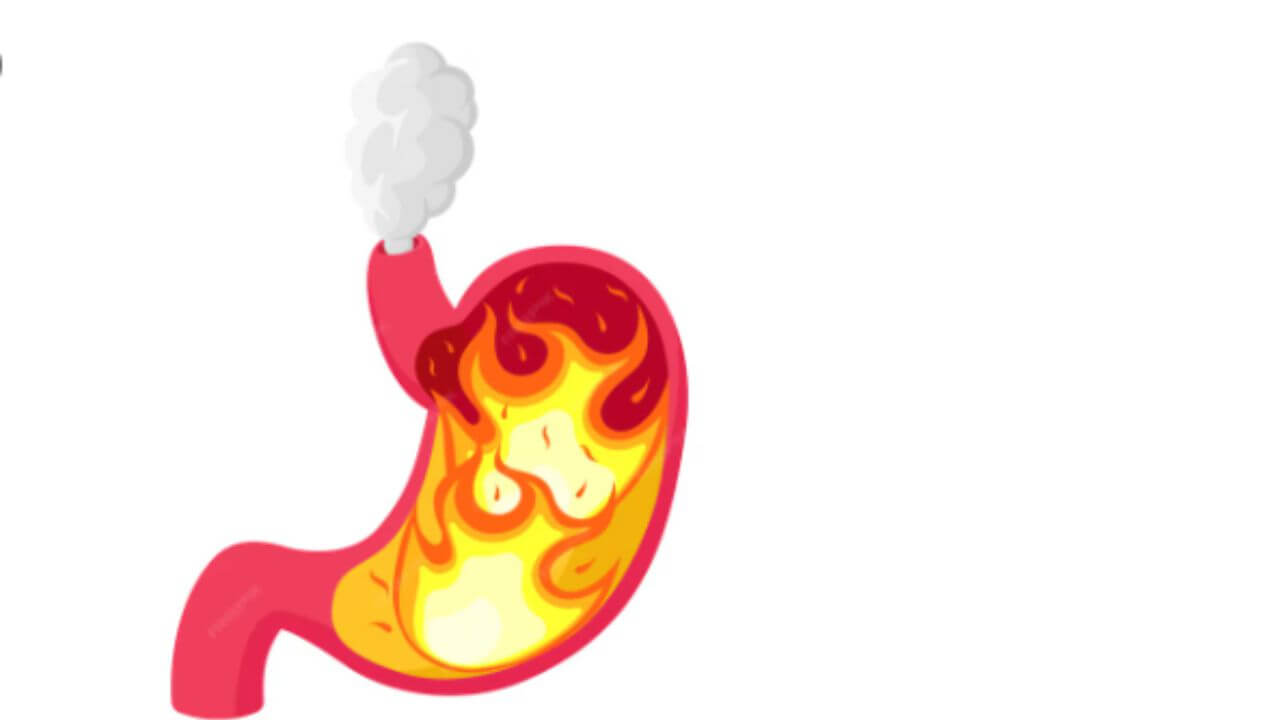 रोजच्या आहारातील ‘या’ ४ पदार्थांमुळे वाढते आम्लपित्त, योग्य प्रमाणात करा सेवन