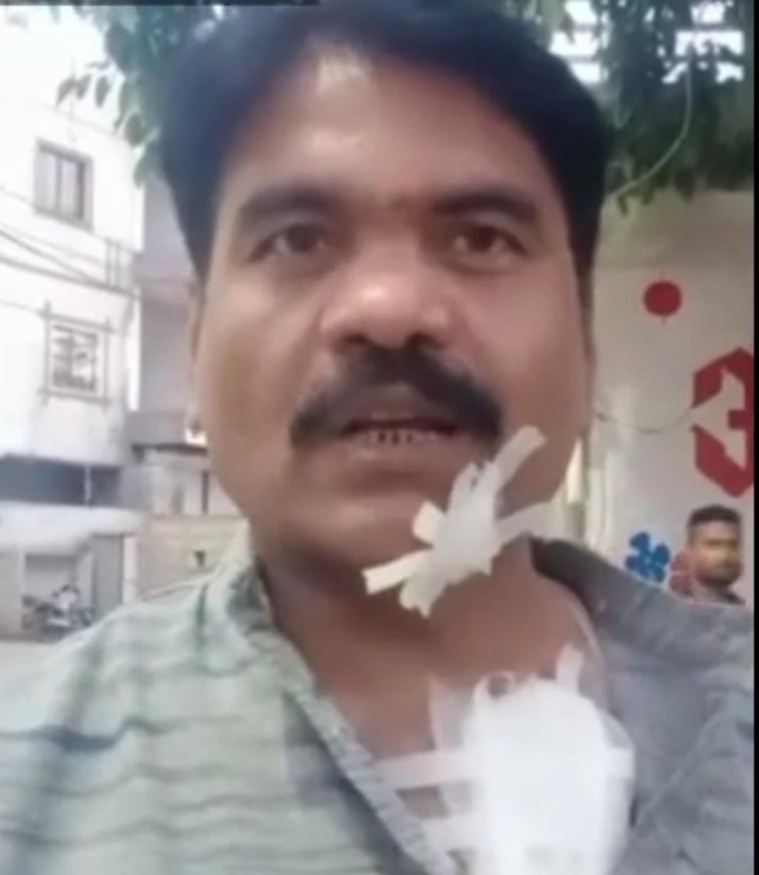 भोपाल के बैरागढ़ में रेल्वे फाटक गिरा, लोग घायल