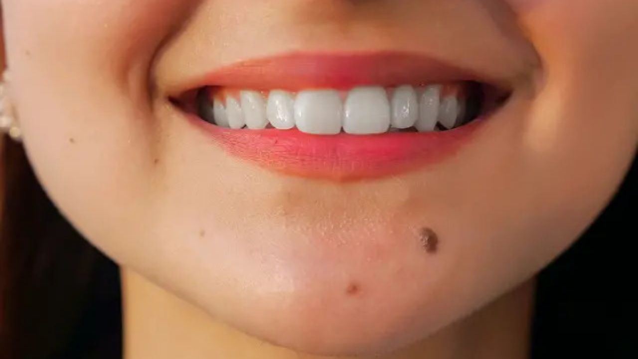 Lucky Moles: लड़कियों के फेस पर तिल होना उनकी खूबसूरती को बढ़ाता है, इन बातों का भी देता है संकेत