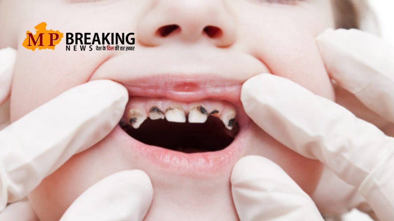 गर्मियों में ड्राय माउथ और दाँतों की सड़न से परेशान है?, कैविटी से बचने के लिए अपनाएँ ये आसान हेल्थ टिप्स!
