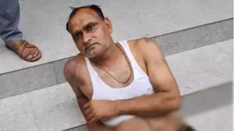 लेनदेन विवाद में सहायक सचिव का किया अपहरण, 13 घंटे बंधक बनाकर बेरहमी से पीटा, पुलिस ने दर्ज किया केस